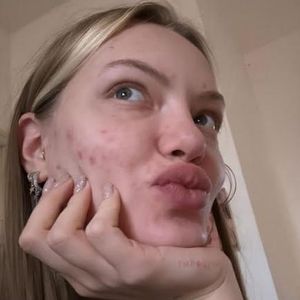Ohne Make-up: Cheyenne Ochsenknecht zeigt ihre Akne im Netz