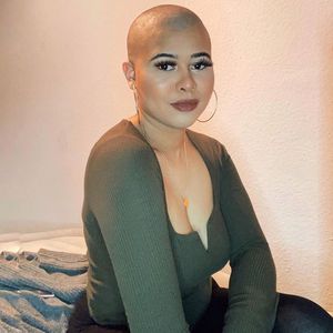 Nach Drillingslüge: TikTokerin Chioma Amber trägt nun Glatze