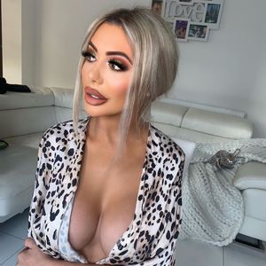 Nach Herzschmerz-Diät: Fans sorgen sich um Chloe Ferry