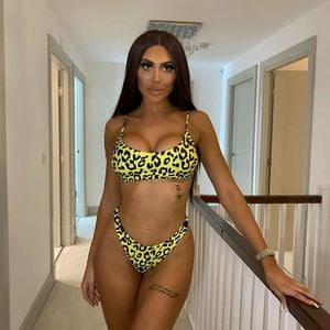 Kaum erkannt: Bräunungsfail von Chloe Ferry sorgt für Lacher
