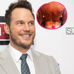 Das muss wehtun! Chris Pratt präsentiert Mega-Sonnenbrand