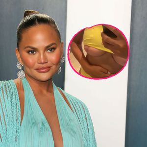 Extrem ehrlich! Chrissy Teigen zeigt Brust-OP-Narben