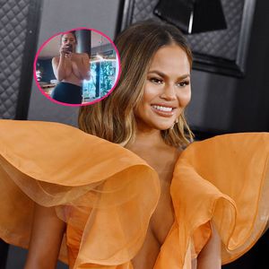 Nach Brust-OP: Model Chrissy Teigen zeigt sich oben ohne