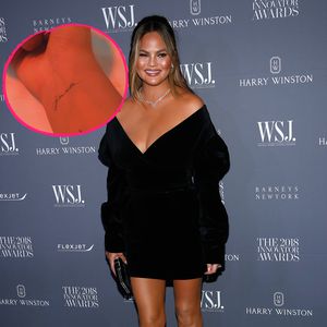 Chrissy Teigen hat jetzt ein Tattoo für ungeborenen Sohn (†)