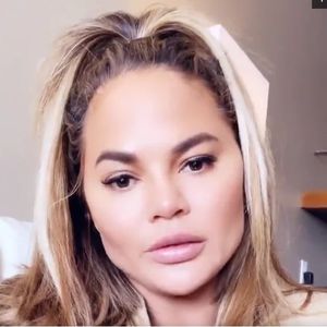 Für markante Züge: Chrissy Teigen ließ Wangenfett entfernen