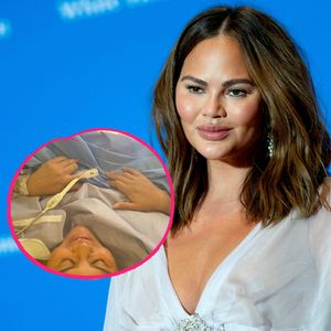Chrissy Teigen teilt intimen Einblick in ihren Kaiserschnitt