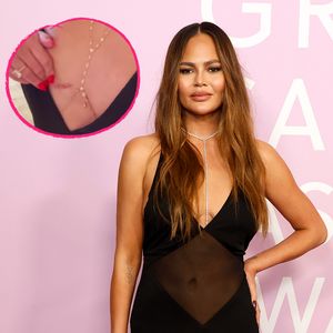 Tiefer Einblick: Chrissy Teigen zeigt ihre OP-Narben