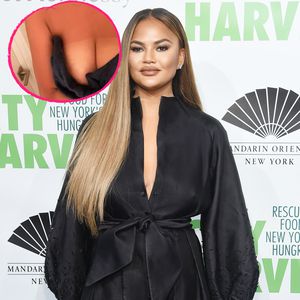 Weiße Brüste: Chrissy Teigen zeigt ihren Bräunungs-Fail