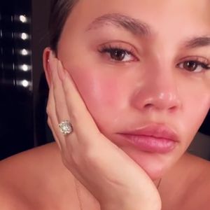 Nach Augenbrauen-Transplantation: Chrissy Teigen gibt Update