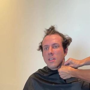 Zu viel Stress: Christian Wolf brauchte Haartransplantation!