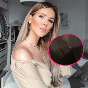 Hose geplatzt: Christin Kaeber kämpft mit Schwanger-Kilos
