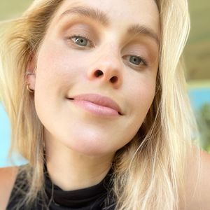 In Schwangerschaft: Claire Holt litt an Hyperpigmentierung
