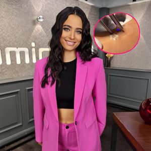 Langzeitprojekt: Amira Pocher lässt alle Tattoos entfernen!