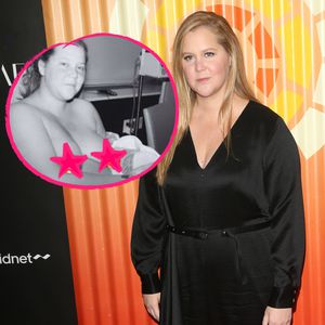 Offen: Amy Schumer teilt ein neues Bild kurz nach der Geburt