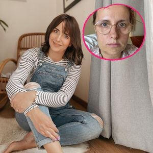 Anna Heiser zeigt ihre krasse Unterkiefer-Transformation!