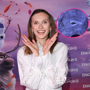 Erstes Ultraschallbild: Schwangere Anna Wilken extrem stolz