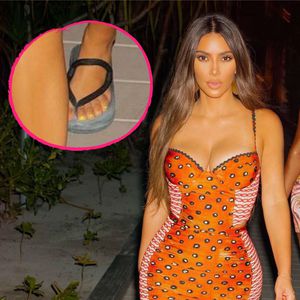 Schon wieder! Hat Kim Kardashian tatsächlich sechs Zehen?