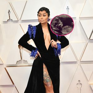 Schwanger? Blac Chyna postet verdächtiges Ultraschall-Foto!