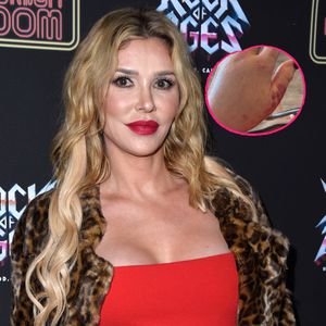 Mysteriöse Infektion: Brandi Glanville droht Amputation!