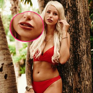 Entenschnabel: Lippen-Spritz-Fail bei Bachelor-Babe Carina?