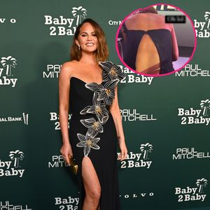 Fashion-Panne: Chrissy Teigens Kleid reißt bei Gala auf!