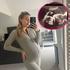 Dani Dyer teilt ein Ultraschallbild von eineiigen Zwillingen