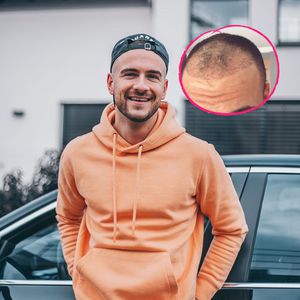 Nach Haartransplantation: Daniel Gielniak gibt ein Update