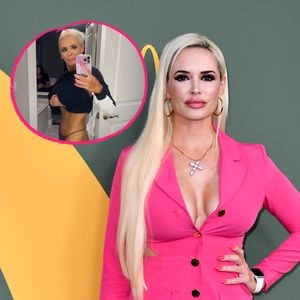 Selbstbräuner-Fail: Daniela Katzenberger übersät von Flecken