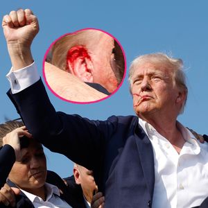 Nach Schießerei: Donald Trump muss nicht operiert werden!