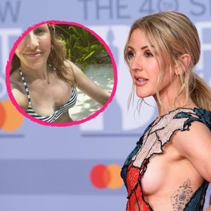 Etwas zu heiß: Ellie Goulding verbrannte sich ihre Brüste!