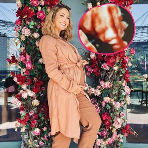 Wow: Fiona Erdmann zeigt 3D-Bild ihres ungeborenen Babys
