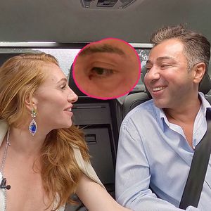 Mega zerkratzt! Hatten Kubi und Georgina gewaltsamen Streit?