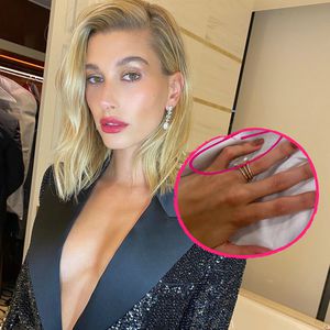Gekrümmter Finger: Hailey Bieber hat eine genetische Störung
