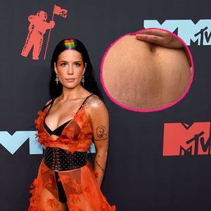 Ehrliches Pic: Neu-Mama Halsey zeigt ihre Dehnungsstreifen