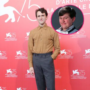 Gewusst? Erschlankter "Harry Potter"-Dudley trug Fatsuit