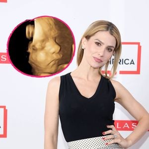 Hilaria Baldwin freut sich über neues Baby-Ultraschallbild!