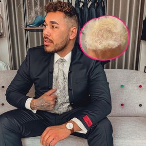 Mit Blondierung im Lift gefangen: BTN-Star fallen Haare aus