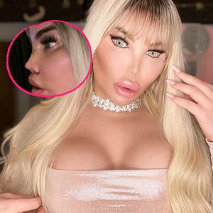 Zwölftes Mal: Jessica Alves hat schon wieder eine neue Nase