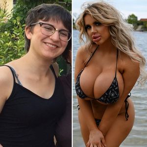 Erkannt? So sah Jessy Bunny vor ihren ganzen Beauty-OPs aus