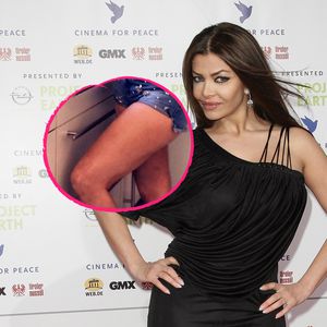 Quarantäne-Dellen: Kader Loth zeigt jetzt ihre Cellulite!