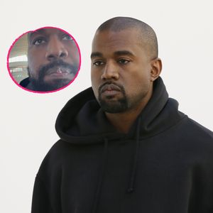 Wegen seiner Titanzähne: Fans sind in Sorge um Kanye West!