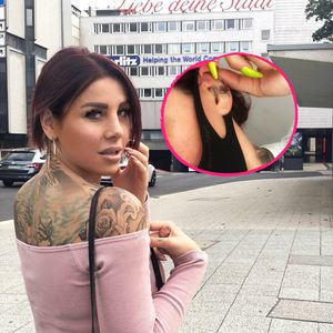 Nach Ohrenkorrektur: Kate Merlan kann sich kaum bewegen!