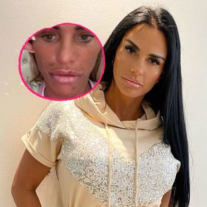 Fieser Botox-Fail! Katie Price konnte nicht mehr lächeln