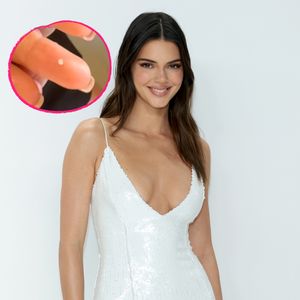 Lachflash: Kendall Jenner bricht sich ein Stück vom Zahn ab