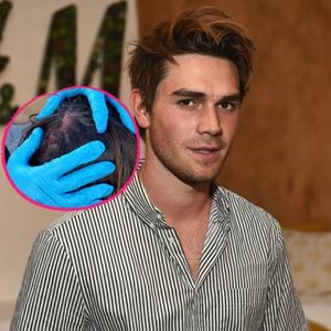 Nach Augenverletzung: Pechvogel KJ Apa hat blutige Kopfwunde