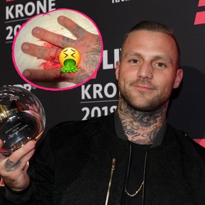 Blutige Wunde am Finger: Kontra K erklärt Videodreh-Unfall