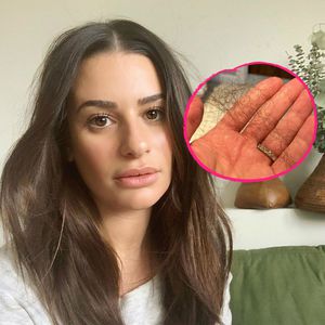 Nach Geburt: Neu-Mama Lea Michele klagt über Haarausfall