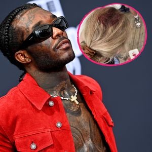 Lil Uzi Vert verletzte mit einem Handy einen Fan am Kopf!
