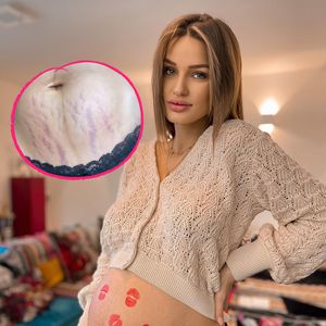 Ehrlich: Neu-Mama Neele Bronst zeigt ihre Dehnungsstreifen