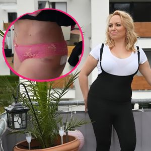 Fünf Tage nach Beauty-OP: "5 Senses"-Nicole zeigt Ergebnisse